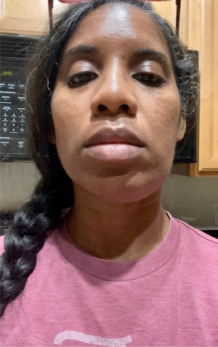 My infected tooth compounded my stress.